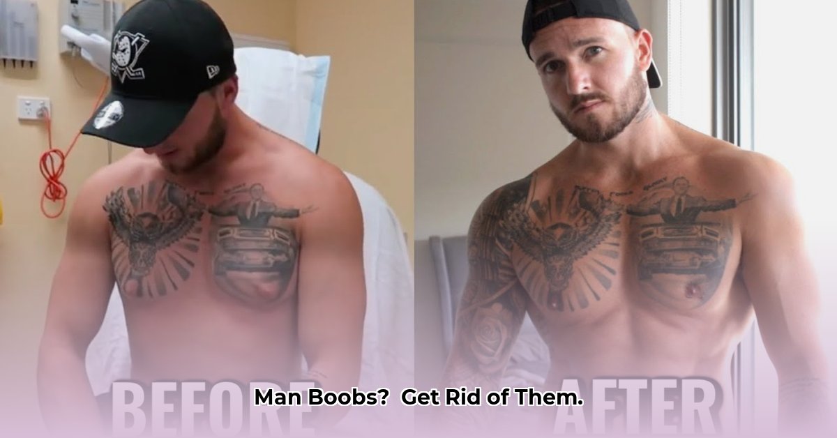 gyno-after-weight-loss